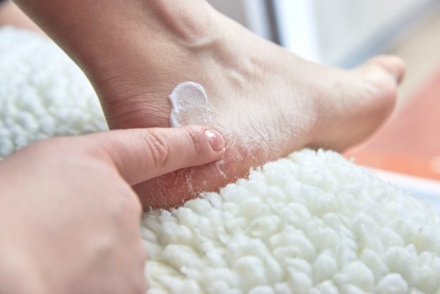 A woman puts heel cream on her feet